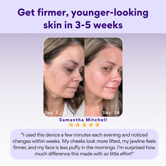 The DermaSculpt Pro (5 Minute Facelift)